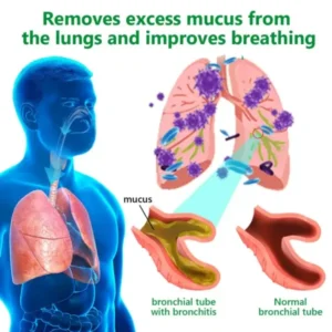 𝗠𝘂𝗹𝗹𝗲𝗶𝗻 𝗖𝗹𝗲𝗮𝗿 𝗟𝘂𝗻𝗴 𝗥𝗲𝗽𝗮𝗶𝗿 𝗖𝗿𝗲𝗮𝗺