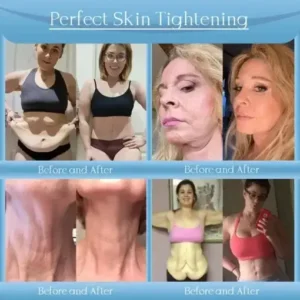 Anti-Wrinkle Skin Cream