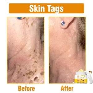 Bee Venom Comprehensive Cream