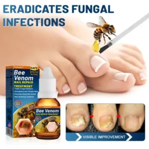 Bee Venom Nail Repair Treatment