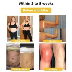 Four-Leaf Clover Lymphvity Magne Therapy Germanium Earrings