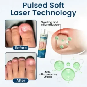 Fungal Repair Herbal Spray