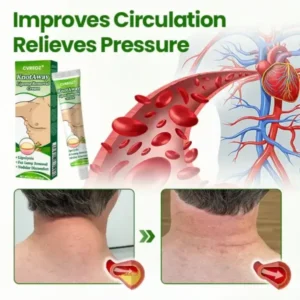 KnotAway Lipoma Removal Cream