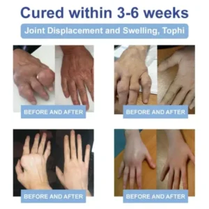 Magnesium Pain Healing Bone Cream