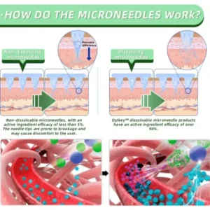 Nano Microneedle Patch