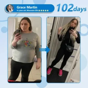 Nano Microneedle Patch with SMGT-GLP-1 & Matrixyl 3000