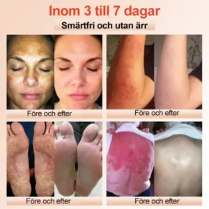 Purifying Peeling Gel