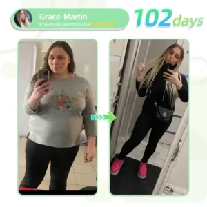 SMGT-GLP-1 Nano Microneedle Patch