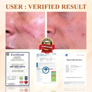 SiliconeFoam Healing Pads