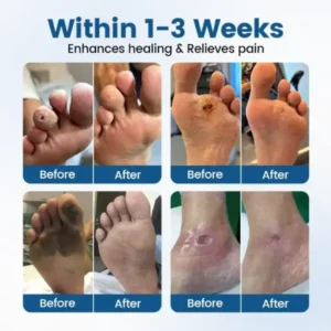 Timilk® AngioVita Diabetic Care Spray