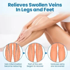 VeinGuard Herbal Spray