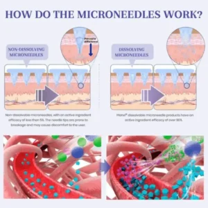 𝗡𝗮𝗻𝗼 𝗠𝗶𝗰𝗿𝗼𝗻𝗲𝗲𝗱𝗹𝗲 𝗣𝗮𝘁𝗰𝗵