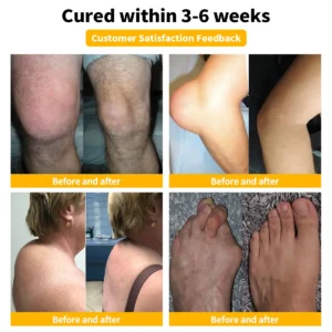 Alternative view of Bee Venom Advanced Joint and Bone Therapy Cream