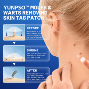 Moles & Warts Removing Skin Tag Patch