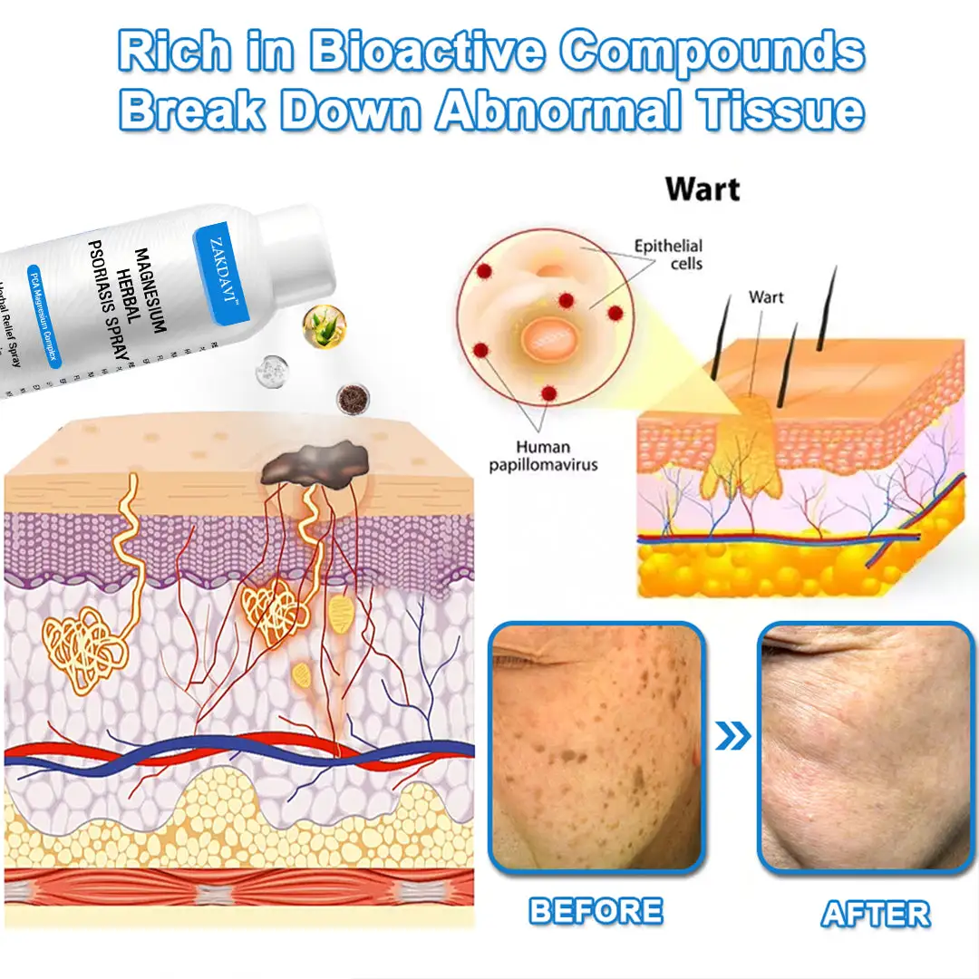 Magnesium Herbal Psoriasis Spray - Image 11