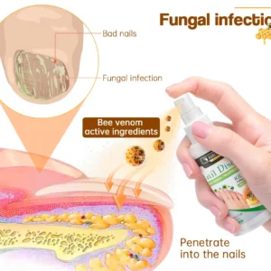 Alternative view of Bee Venom Nail Disease Treatment Spray