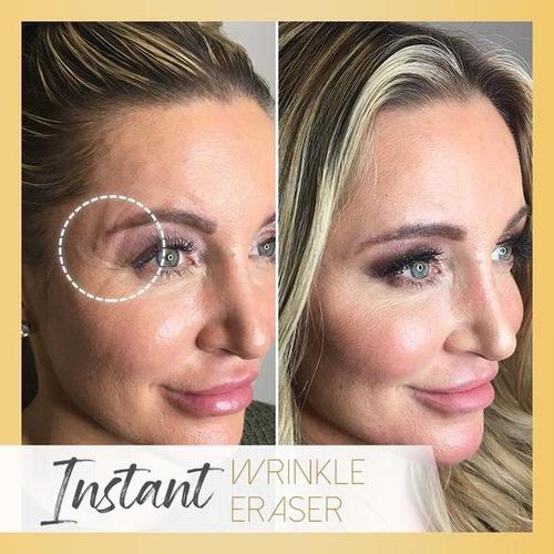 Instant Magic Lift Pro - Image 4