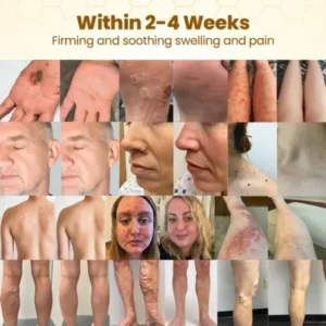 Alternative view of BeeDerma Repair Cream