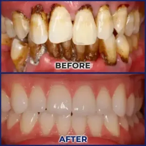 Alternative view of ApiGuard BeeVenom Therapeutic Oral Drops & Rinse