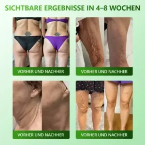 Alternative view of 𝗬𝗼𝘂𝐭𝐡𝐆𝗹𝗼𝘄 𝑺𝒕𝙖𝙢𝙢𝙯𝙚𝒍𝒍𝒆𝒏 𝙆𝙤𝒍𝒍𝒂𝙜𝙚𝒏 𝗧𝗿𝗼𝒑𝐟𝙚𝙣