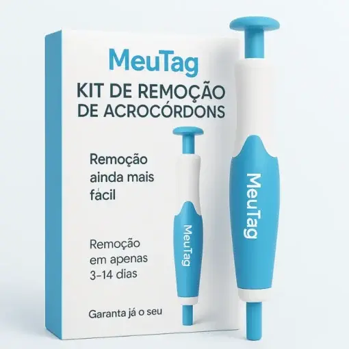 – Skin Wart & Skin Tag Removal Kit - Image 5
