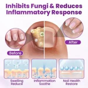 Alternative view of AeroFilm Foot Defense Mist