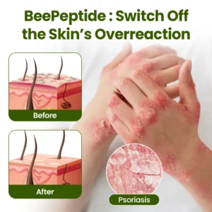 Alternative view of BeePeptide RootSoft DualRelief Cream