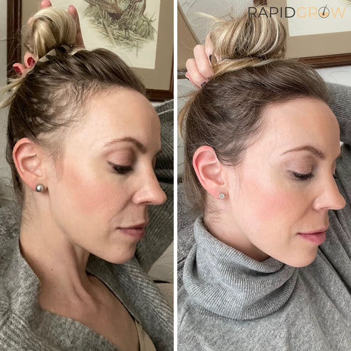 - Ginger Hair Growth Shampoo - Image 2