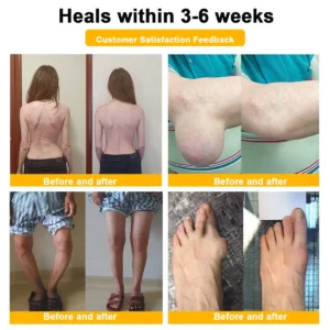 Alternative view of Bee-Venom Pain-Relief Bone Healing Cream