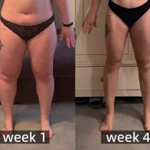 Alternative view of 𝐁𝐞𝐞 𝐕𝐞𝐧𝐨𝐦 𝐅𝐨𝐨𝐭 𝐒𝐨𝐥𝐞 𝐀𝐜𝐮𝐩𝐨𝐢𝐧𝐭 𝐃𝐫𝐚𝐢𝐧𝐚𝐠𝐞 𝐇𝐞𝐚𝐥𝐭𝐡 𝐏𝐚𝐭𝐜𝐡