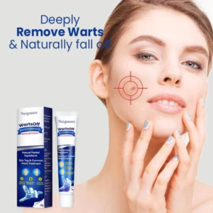 Alternative view of WartsOff Instant Blemish Removal Cream