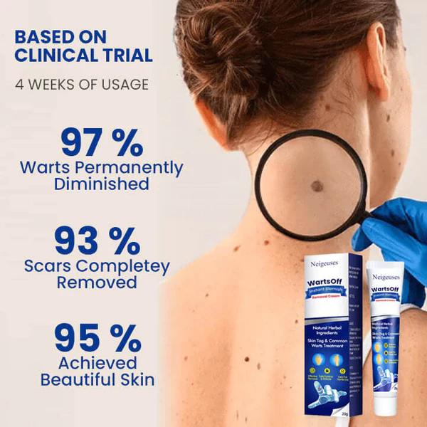 WartsOff Instant Blemish Removal Cream - Image 6