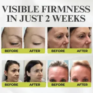 Alternative view of Botox & Vita-A Retinol Shot Wrinkle-Lift Tightening cream