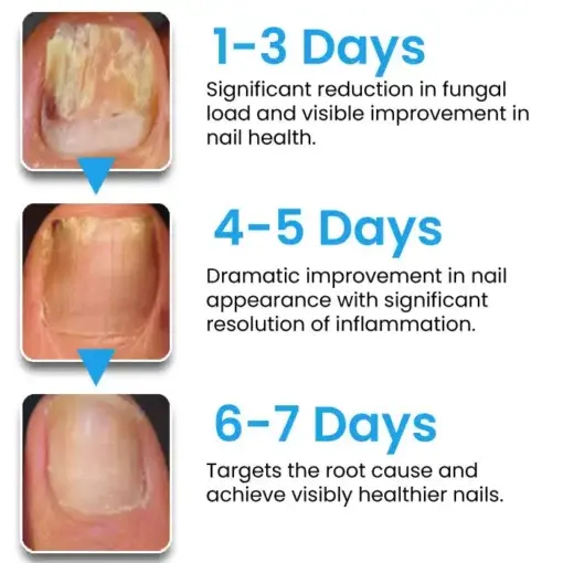 NanoFix Repair Pen - Image 6