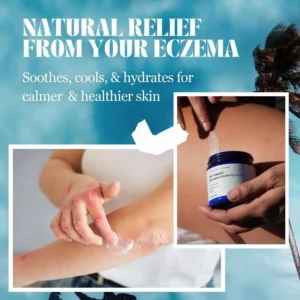 Alternative view of All Natural Eczema Soothing Cream
