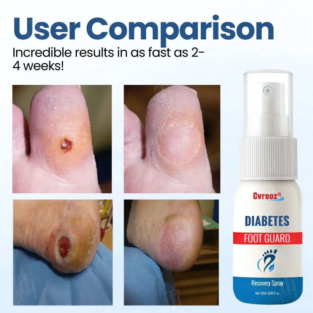 ๐๐ข๐๐๐๐ญ๐๐ฌ ๐
๐จ๐จ๐ญ ๐๐ฎ๐๐ซ๐ ๐๐๐๐จ๐ฏ๐๐ซ๐ฒ ๐๐ฉ๐ซ๐๐ฒ - Image 2