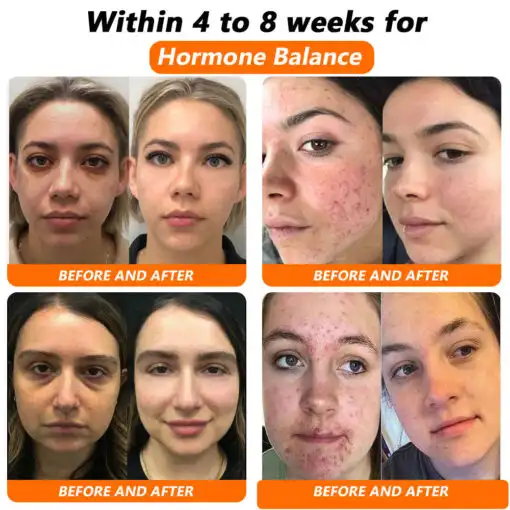 Bee Venom NMN Natural Repair Vaginal Capsules - Image 3