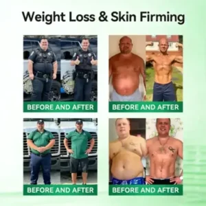 Alternative view of 10-IN-1,Moringa-Slimming and Fat-Burning Hot Cream (Once Daily, visiblechanges in 7 days)Obesity, Diabetes, SleepApnea, And Joint Issues