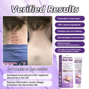 Alternative view of 𝖠𝖽𝗏𝖺𝗇𝖼𝖾𝖽 𝖲𝖼𝖺𝗋 𝖦𝖾𝗅