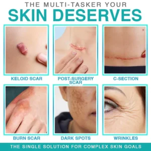 Alternative view of 3-in-1 Microneedle Care Patch