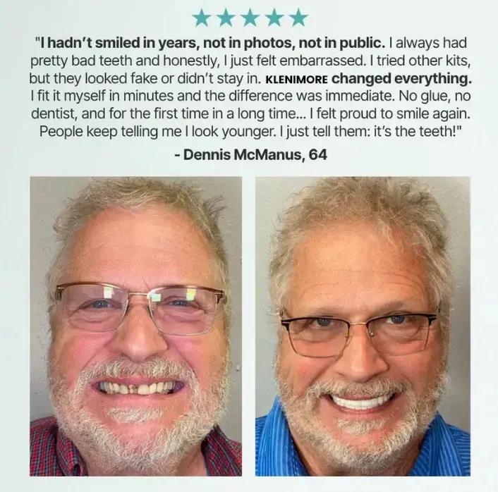 : 😁Dentures That Stay. Smile With Confidence😁 - Image 8