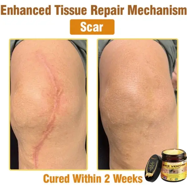 Botulinum Toxin & BEE Venom Pain-Relief Bone Healing Cream - Image 6