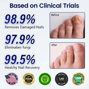 Alternative view of Anti-Fungal Nail Repair Patch