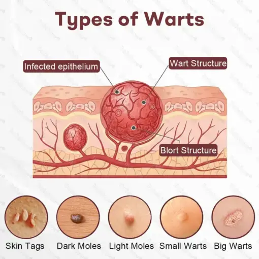 BlackRice Wart Recovery Cream Suitable for all skin types - Image 3