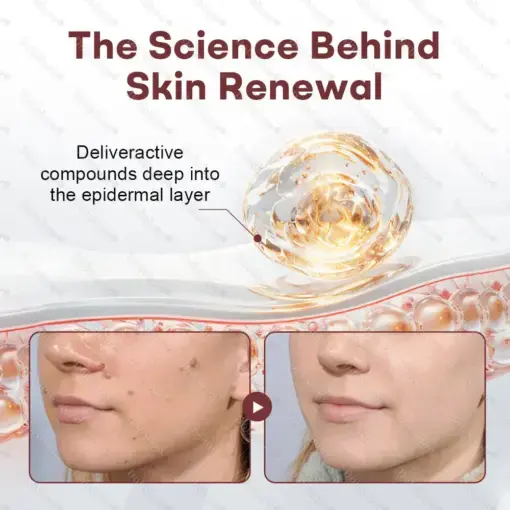 BlackRice Wart Recovery Cream Suitable for all skin types - Image 4