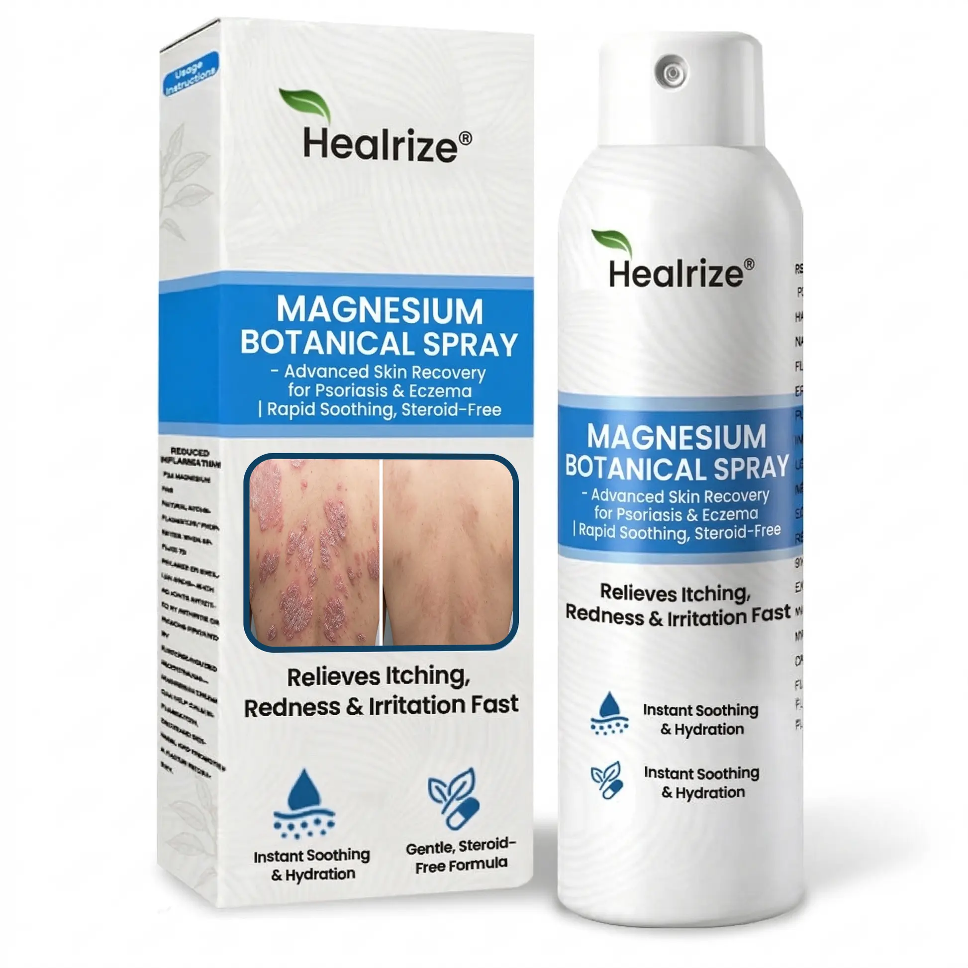 Magnesium Botanical Spray – Advanced Skin Recovery for Psoriasis & Eczema - Image 11