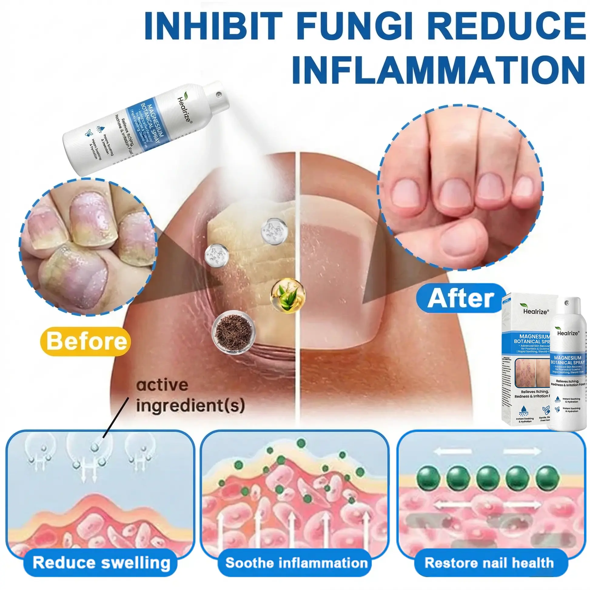 Magnesium Botanical Spray – Advanced Skin Recovery for Psoriasis & Eczema - Image 4