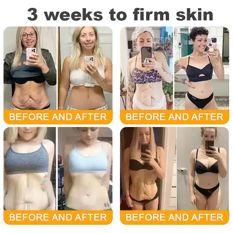 Bee Poison Skin Restoration Cream - Image 14