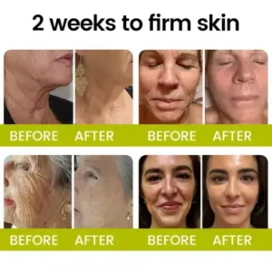 Alternative view of Botox Retinol Shot Smoother-Looking Skin for Deep Lines, Sagging Jowls Puffy Eyes