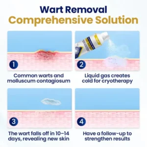 Alternative view of Chillique Bump Renewal Spray